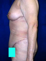 Weight Loss | Cleveland