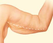 07 arm lift 01