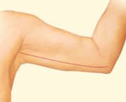 07 arm lift 02