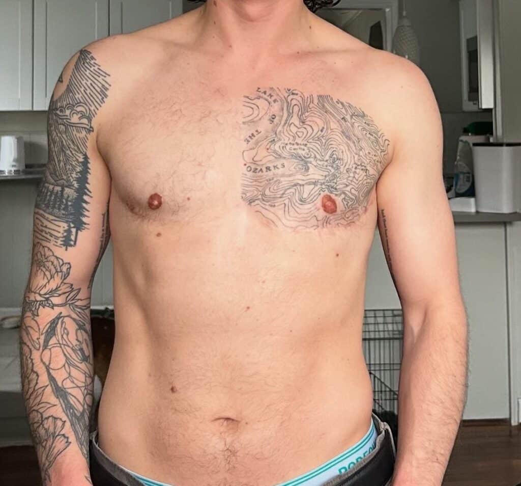 Ftm Di after