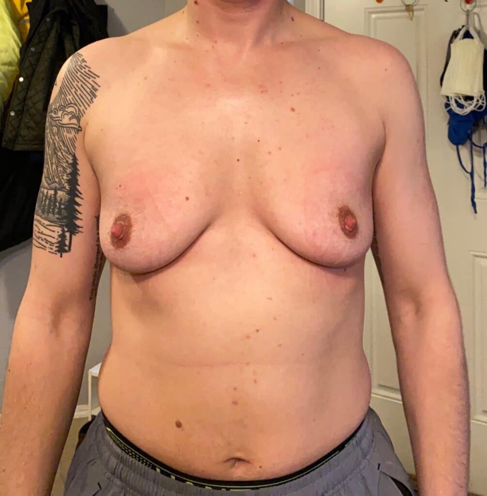 Ftm Di before