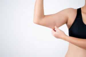 Woman pinching loose upper-arm skin after weight loss while considering arm lift surgery.