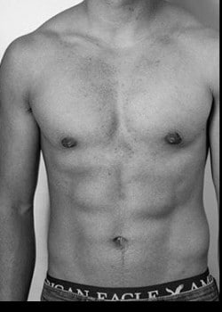 After Image: Gender Confirmation Top Surgery via a peri-areolar approach - front