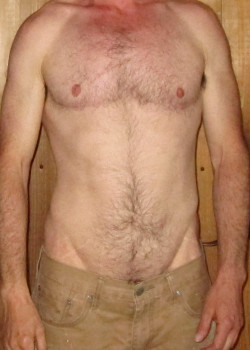 After Image: FtM DI Top Surgery - front